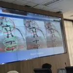 Kawat Tertinggal di Jantung Pasien Cuci Darah, RSUD AWS Buka Suara